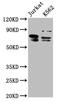 Thymocyte Selection Associated antibody, CSB-PA850780LA01HU, Cusabio, Western Blot image 