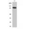 Signal Transducer And Activator Of Transcription 5A antibody, LS-C386212, Lifespan Biosciences, Western Blot image 