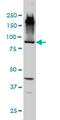 EMAP Like 1 antibody, LS-C197131, Lifespan Biosciences, Western Blot image 