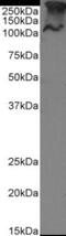 Mucin 1, Cell Surface Associated antibody, NBP2-62561, Novus Biologicals, Western Blot image 