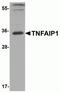 TNF Alpha Induced Protein 1 antibody, NBP2-82039, Novus Biologicals, Western Blot image 