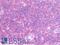 Interferon Gamma Inducible Protein 16 antibody, LS-B10051, Lifespan Biosciences, Immunohistochemistry paraffin image 