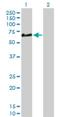 Complement Factor H Related 5 antibody, H00081494-D01P, Novus Biologicals, Western Blot image 