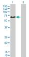 Complement factor H-related protein 5 antibody, H00081494-D01P, Novus Biologicals, Western Blot image 