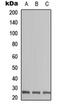 Zinc Finger CCHC-Type Containing 17 antibody, orb304666, Biorbyt, Western Blot image 