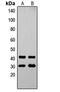 Ovo Like Transcriptional Repressor 1 antibody, GTX55272, GeneTex, Western Blot image 