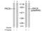 Protein Kinase C Delta antibody, GTX78968, GeneTex, Western Blot image 