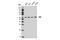 Cystathionine-Beta-Synthase antibody, 14782S, Cell Signaling Technology, Western Blot image 