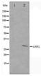Apoptotic Peptidase Activating Factor 1 antibody, LS-C415817, Lifespan Biosciences, Western Blot image 