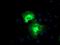 Proteasome 26S Subunit, Non-ATPase 2 antibody, MA5-25624, Invitrogen Antibodies, Immunocytochemistry image 