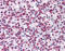 DNA Topoisomerase II Alpha antibody, 51-523, ProSci, Immunohistochemistry frozen image 