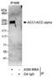 Acetyl-CoA Carboxylase Alpha antibody, A300-986A, Bethyl Labs, Immunoprecipitation image 