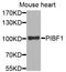 Progesterone Immunomodulatory Binding Factor 1 antibody, STJ24985, St John
