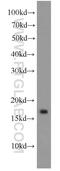 GABA Type A Receptor Associated Protein Like 1 antibody, 11010-1-AP, Proteintech Group, Western Blot image 
