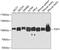 DNA topoisomerase 1 antibody, GTX55820, GeneTex, Western Blot image 
