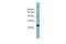 Mastermind Like Transcriptional Coactivator 3 antibody, PA5-43079, Invitrogen Antibodies, Western Blot image 