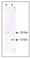 Transforming Growth Factor Beta 1 antibody, AP07828PU-N, Origene, Western Blot image 
