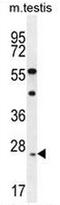 Rhophilin Associated Tail Protein 1 Like antibody, AP53700PU-N, Origene, Western Blot image 