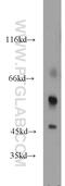 Lymphotoxin Beta Receptor antibody, 20331-1-AP, Proteintech Group, Western Blot image 