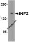 Inverted Formin, FH2 And WH2 Domain Containing antibody, 8631, ProSci, Western Blot image 