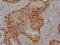 Protein Arginine Methyltransferase 5 antibody, CSB-RA176962A0HU, Cusabio, Immunohistochemistry frozen image 