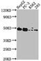 Protein O-glucosyltransferase 1 antibody, CSB-PA818754LA01HU, Cusabio, Western Blot image 