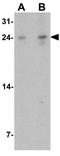 Transmembrane And Immunoglobulin Domain Containing 1 antibody, GTX32126, GeneTex, Western Blot image 