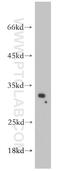 SPINK1 antibody, 55100-1-AP, Proteintech Group, Western Blot image 