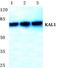 Anosmin 1 antibody, PA5-75526, Invitrogen Antibodies, Western Blot image 