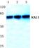 KAL antibody, PA5-75526, Invitrogen Antibodies, Western Blot image 