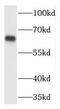 Transmembrane Phosphatase With Tensin Homology antibody, FNab08908, FineTest, Western Blot image 