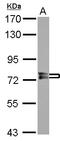 Protein Phosphatase With EF-Hand Domain 1 antibody, LS-C155387, Lifespan Biosciences, Western Blot image 