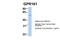 G Protein-Coupled Receptor 161 antibody, 25-760, ProSci, Enzyme Linked Immunosorbent Assay image 