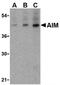 CD5 Molecule Like antibody, AP05584PU-N, Origene, Western Blot image 
