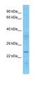 TRNA Splicing Endonuclease Subunit 34 antibody, orb327398, Biorbyt, Western Blot image 