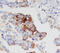 Mesothelin antibody, MAB32651, R&D Systems, Immunohistochemistry paraffin image 