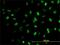 Meis Homeobox 2 antibody, H00004212-M01, Novus Biologicals, Immunofluorescence image 
