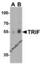 Toll Like Receptor Adaptor Molecule 1 antibody, 3173, ProSci, Western Blot image 