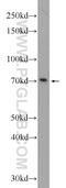 HIC ZBTB Transcriptional Repressor 1 antibody, 24949-1-AP, Proteintech Group, Western Blot image 