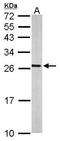 RAS Like Proto-Oncogene A antibody, TA308408, Origene, Western Blot image 