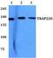 Mediator Complex Subunit 1 antibody, PA5-36200, Invitrogen Antibodies, Western Blot image 