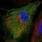 AB1IP antibody, PA5-64138, Invitrogen Antibodies, Immunofluorescence image 