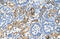 Heterogeneous Nuclear Ribonucleoprotein L antibody, 29-274, ProSci, Immunohistochemistry paraffin image 