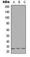 Immunoglobulin Lambda Like Polypeptide 1 antibody, LS-C356113, Lifespan Biosciences, Western Blot image 