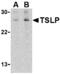Thymic Stromal Lymphopoietin antibody, MBS150610, MyBioSource, Western Blot image 