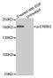 Erb-B2 Receptor Tyrosine Kinase 3 antibody, MBS128412, MyBioSource, Western Blot image 