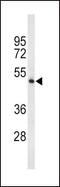 Tryptophan Hydroxylase 2 antibody, PA5-26185, Invitrogen Antibodies, Western Blot image 