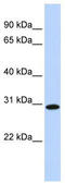 Survival Motor Neuron Domain Containing 1 antibody, TA345934, Origene, Western Blot image 