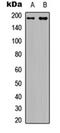 Insulin Receptor Substrate 1 antibody, orb315569, Biorbyt, Western Blot image 