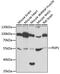 Pyruvate Dehyrogenase Phosphatase Catalytic Subunit 1 antibody, GTX54635, GeneTex, Western Blot image 